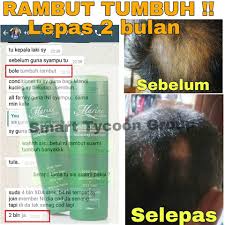 Shampo untuk melebatkan rambut bayi yang biasanya sering dipakai yaitu, zwitsal natural baby hair lotion. Lebatkan Rambut 100 Ori Me Shampoo Shopee Malaysia