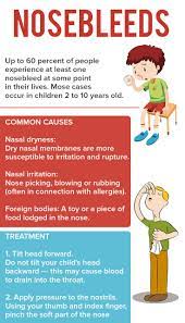 What Are The Causes Of Nosebleeds Healthykids Nosebleeds Commoncauses Https Suz Myshaklee Com Us En Shop Kids Nutrition Healthy Kids How To Stay Healthy