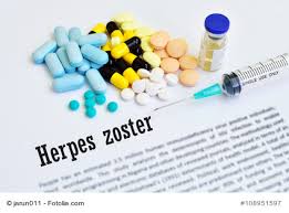 Die für herpes zoster typischen veränderungen auf der haut auch innere organe wie die lunge können betroffen sein. Gurtelrose Ihre Apotheke Informiert Uber Krankheiten