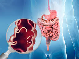 Parasitoses Intestinais – Miudinhos