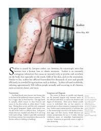 Image result for scabies transmission