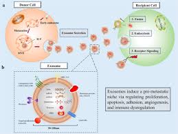 At cancer tutor, we are committed to the cancers can grow quickly or slowly and can form from b cells or t cells. Exosomes Promote Pre Metastatic Niche Formation In Ovarian Cancer Molecular Cancer Full Text