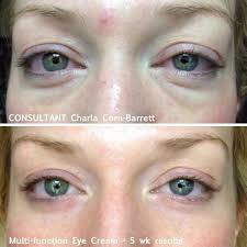 Multi Function Eye Cream Before After Ccaldwell3 Myrandf Com Rodan And Fields Consultant Rodan And Feilds Rodan And Fields