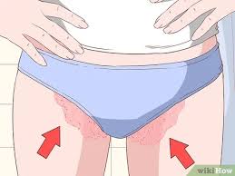 How To Know If You Have Jock Itch 8 Steps With Pictures