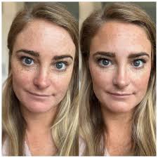 Someone recently asked why Doris' sun freckles are hidden. Doris 'hid' them  under a layer of make-up