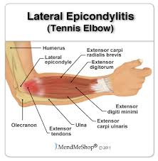 Knowledge of normal anatomy and variations in the tendons of extensor muscles is important for identification of accessory. Forearm Muscle Strain