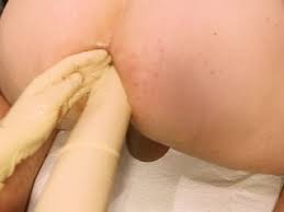 Nurse paris gets kinky with plastic speculum on gynochair. Gynochair