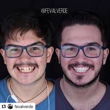 Valverde Odontologia Especializada