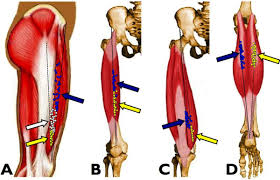 position of the muscle motor points for the quadriceps and