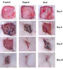 We did not find results for: Wounds Heal Faster With Proline
