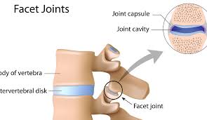 Low Back Pain Fix Sheboygan Wi