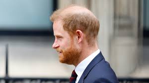 Prince Harry Embrace His Hair Loss ...