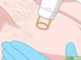 Because lemon has some bleaching properties, it does a great job of concealing hair growth to a large extent. 3 Ways To Reduce Body Hair Growth Wikihow