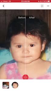 Remini Baby Before and After