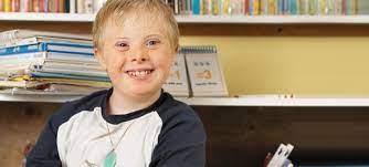 Down Syndrom Ursachen Symptome Und Merkmale