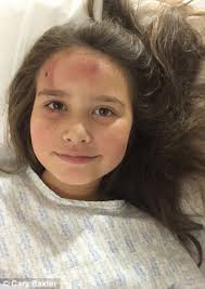 Annie Baxter walked away with cuts after being hit by car travelling at  80km/h