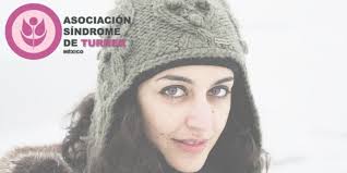 Síndrome de Turner (@turnermexico)