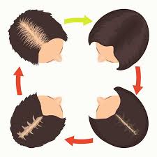 Controls of hair follicle cycling. 9 Things That Cause Hair Loss Masterpiece Skin Restoration