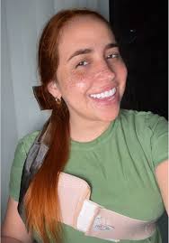 Como se me ven estas pecas?