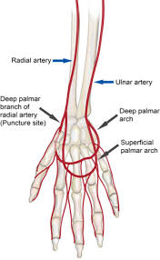 Distal Transradial Access In The Anatomical Snuffbox For Diagnostic Cerebral Angiography Journal Of Neurointerventional Surgery Between the two tendons you will find the anatomical snuff box. distal transradial access in the