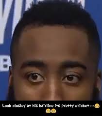 By amanda platell jun 24, 2012. Look Closley At His Hairline Its Pretty Cricket