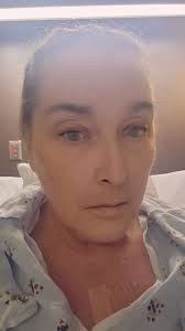 Knee Replacement Support Group ✓ Tips for Pre-OP & Recovery