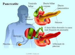Etiologia de la pancreatitis aguda 5.1 necesidad de la evaluación. O Que E Pancreatite Aguda E Cronica E Como Reconhece La