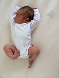 Clubfoot Call Baby Cute766