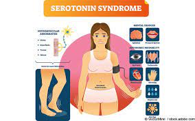 Serotonin Syndrom Gelbe Liste