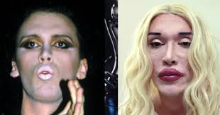 Huyền thoại nhạc Pop người Mỹ gây sốc với 300 lần 'dao kéo'