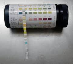 Urine Test Strip Wikipedia