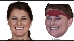 Esthetic dental perception comparisons between 2D- and 3D-simulated dental  discrepancies