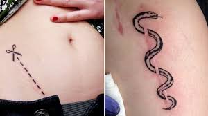 Covering stretch marks is a great alternative to removing, but is it as effective and safe as it sounds? 17 Tattoos That Prove Scars And Stretch Marks Are Works Of Art Revelist