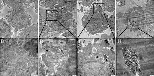 I'm not the best mechanically, but my positioning and anticipation carries me. Induction Of Lipid Droplets In Thp 1 Macrophages By Multi Walled Carbon Nanotubes In A Diameter Dependent Manner A Transcriptomic Study Sciencedirect