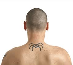 The best tattoo removal on the gold coast. Laser Tattoo Removal Cosmedic Skin Clinic Gold Coast