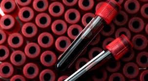 Darker colors == more posting experience here. Phlebotomy Cedp Skill Institute Mumbai