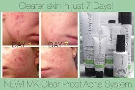 Amazing Results From Mary Kay Clear Proof Acne Fighting Products Simple Acne Fighting Skin Care Regime Www M Mary Kay Skin Care Mary Kay Clearproof Mary Kay
