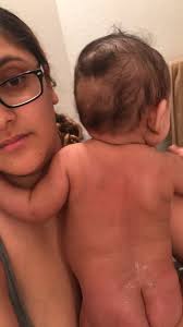 A way to grow small baby hairs? Baby Hair Is Thinning Out And Falling Out January 2018 Babies Forums What To Expect
