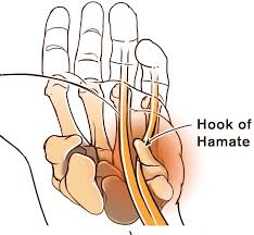Image result for Hamate Bone