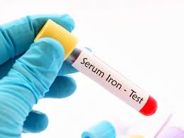 Serum Iron Test Procedure Results And Normal Ranges