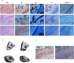 The long bones , longer than they are wide, include the femur (the longest bone in the body) as long bones are mostly located in the appendicular skeleton and include bones in the lower limbs. Biomimetic Matrices For Rapidly Forming Mineralized Bone Tissue Based On Stem Cell Mediated Osteogenesis Scientific Reports