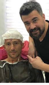 Serkan Aydin Arenamed Sac Ekimi Fiyatlari Ve Yorumlari Sac Unluler Ayi