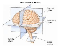 Cross sectional anatomy of brainsource: Structure Of The Nervous System Ppt Video Online Download