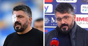 Gattuso had been forced to wear an eye patch in recent matches, something he felt compelled to explain. It S Been Rumoured I M Dying But I M Not Gattuso Reveals His Illness
