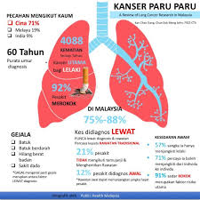 Kanker ini lebih banyak dialami oleh orang yang memiliki kebiasaan merokok dan merupakan satu dari tiga jenis kanker yang paling banyak terjadi di indonesia. Public Health Malaysia Kanser Paru Paru Di Malaysia 88 Pesakit Lewat Percaya Rawatan Tradisional Alternatif Review Of Lung Cancer Reseach In Malaysia Fast Fact I Menyebabkab 4088 Kematian Setiap Tahun