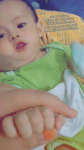 Anak Kuat Mama: Harapan Kesembuhan untuk Hemangioma