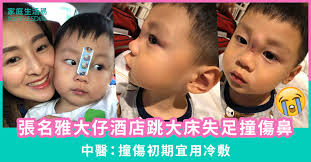 張名雅大仔酒店跳大床失足撞傷鼻- 家庭生活易family.esdlife