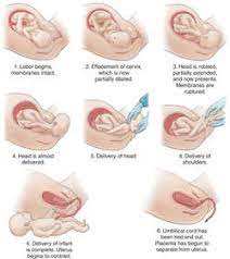 Augmented Labor Definition Of Augmented Labor By Medical Dictionary
