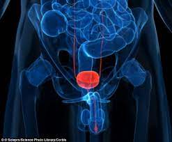 Nutritional programs for prostate cancer prevention include diets rich in zinc and selenium, both of which have been scientifically shown to feed the prostate gland and protect against cancer. New Blood Test Can Find Aggressive Prostate Cancer Tumours Daily Mail Online