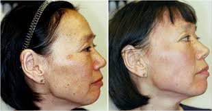 Lynn — VILLANI MEDICAL